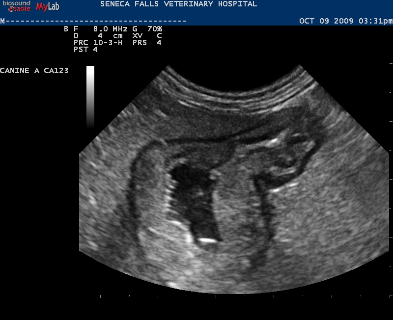 Ultrasound
